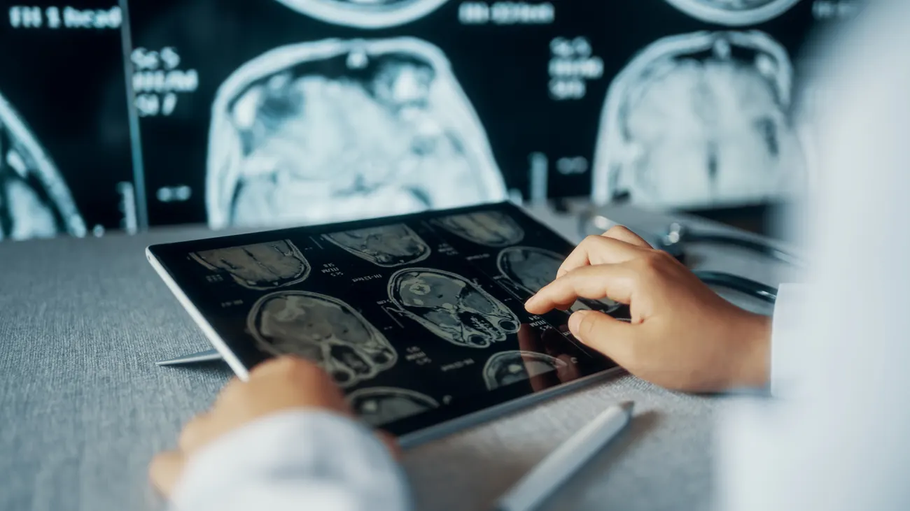 Análisis de resonancia magnética cerebral en tablet